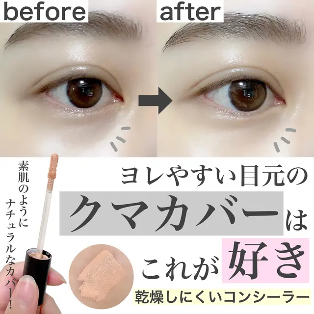 クマ 生まれつき 骨格 Lemon8