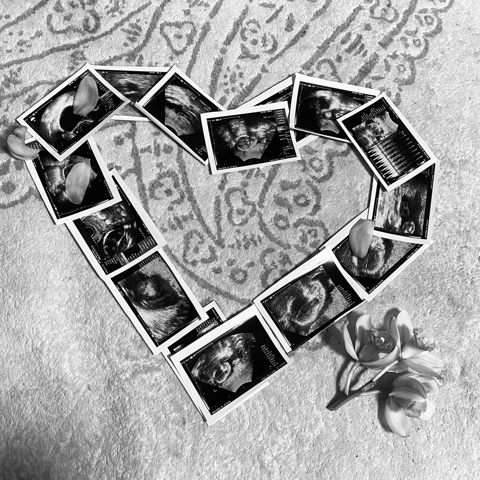 エコー写真 保存 Nonariaが投稿したフォトブック Sharee