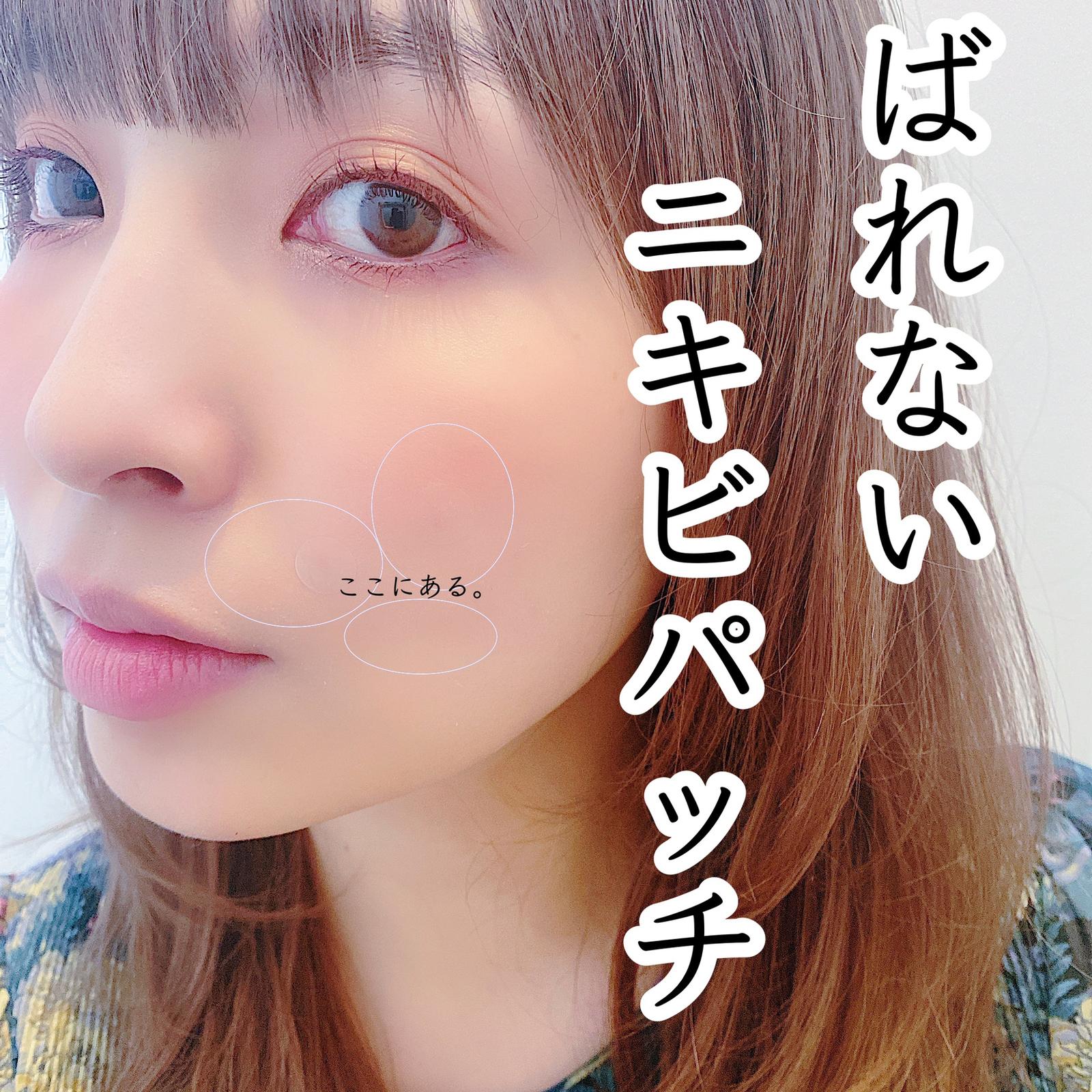 ほんとにバレないニキビパッチ しかも治りも早い マスク摩擦も避けます Kayasautoisaが投稿したフォトブック Sharee