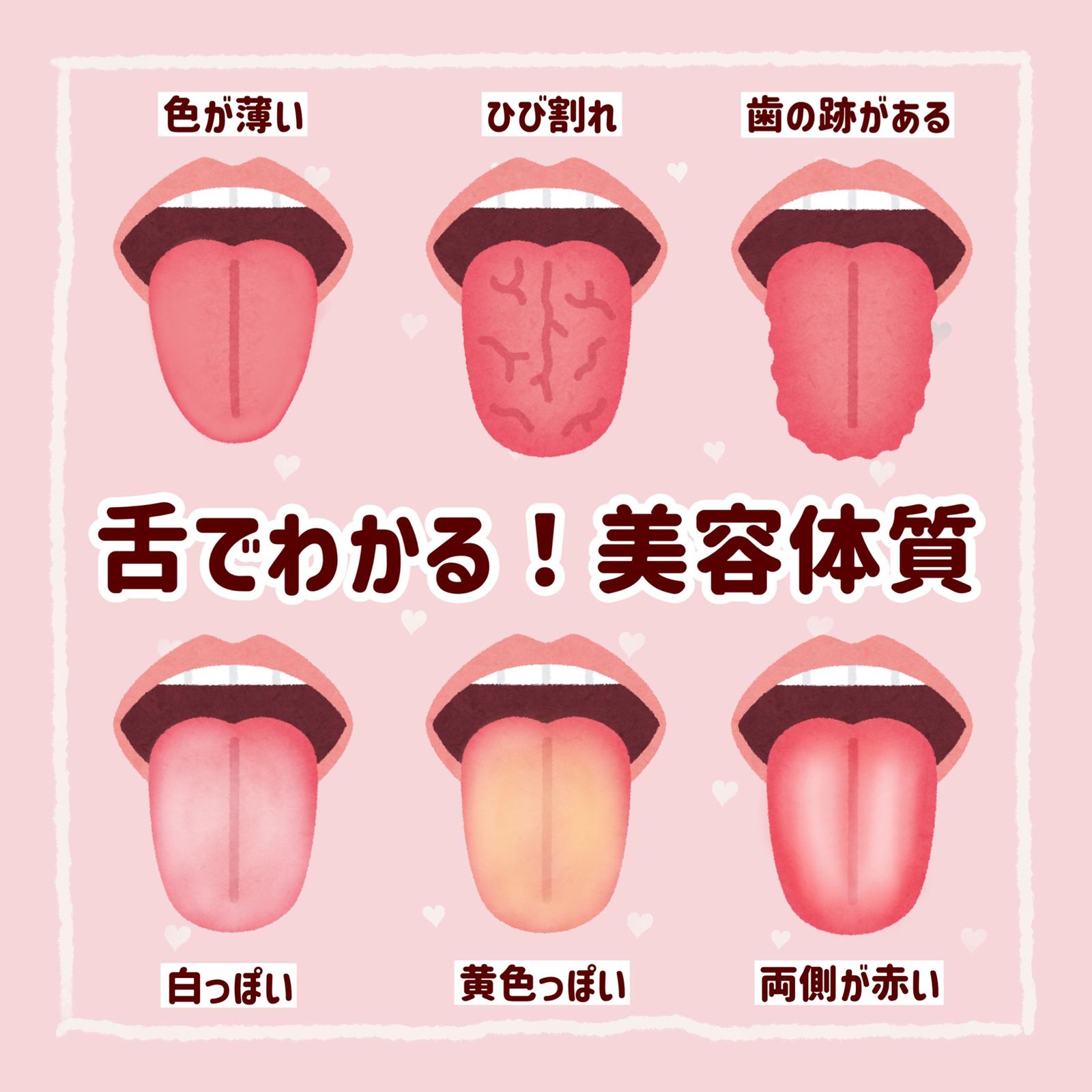 舌でわかる！あなたの美容体質💡の画像 (1枚目)