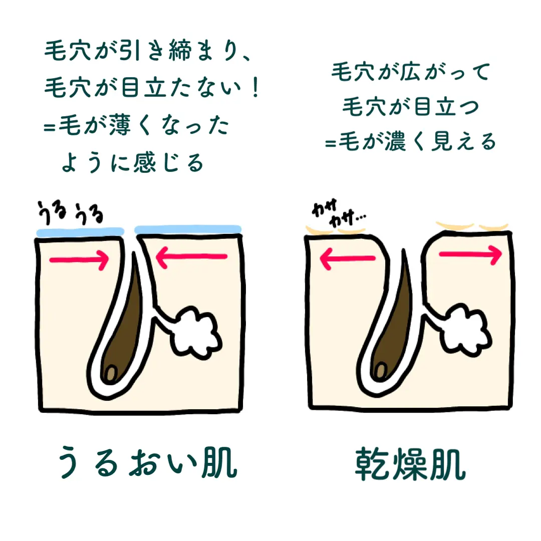 アロエジェルで本当に毛は薄くなる ねるこyoutubeが投稿したフォトブック Lemon8