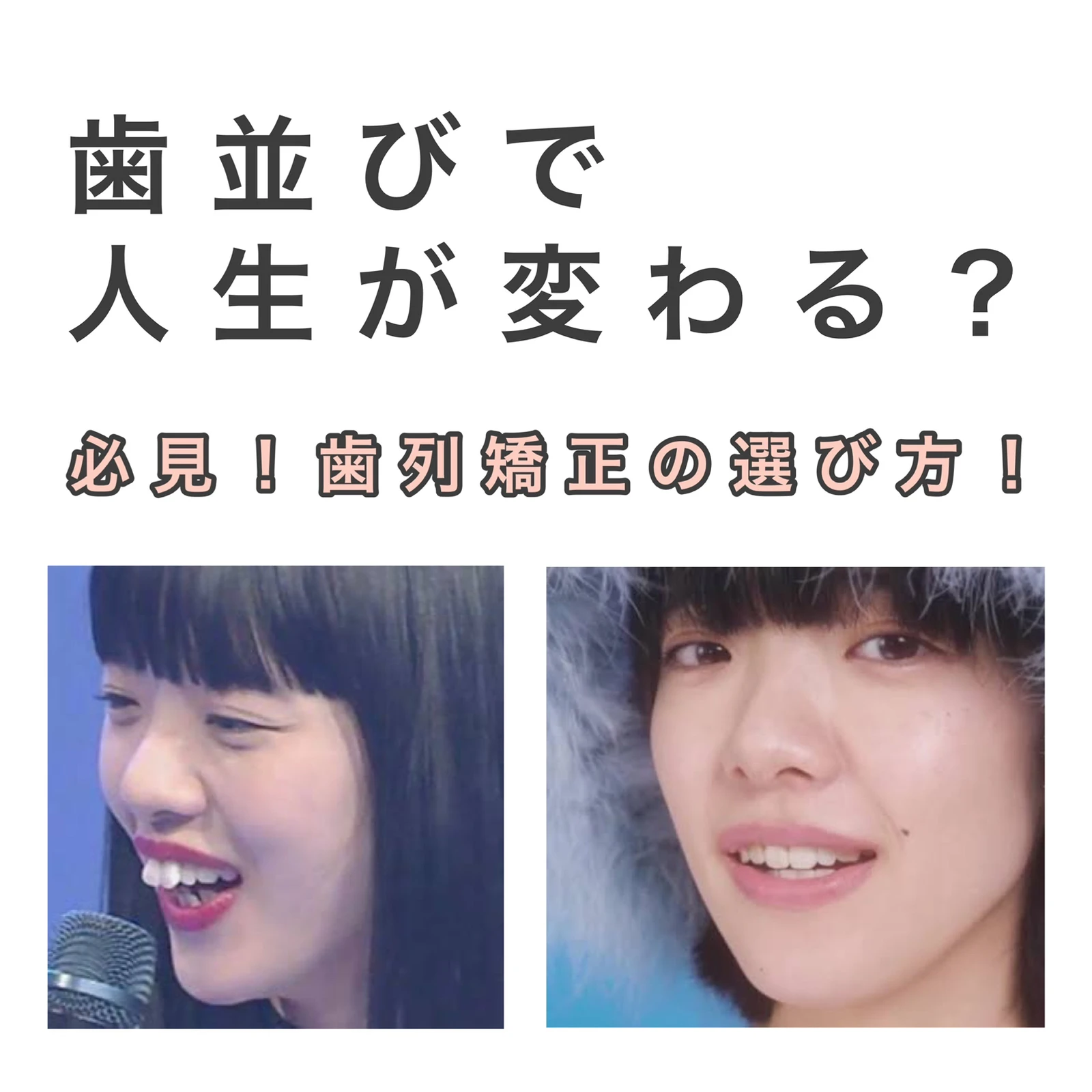 歯医者から聞いた 歯列矯正の真実 Kaoriiiiiii00が投稿したフォトブック Lemon8 歯医者から聞いた 歯列矯正の真実 Kaoriiiiiii00が投稿したフォトブック Lemon8