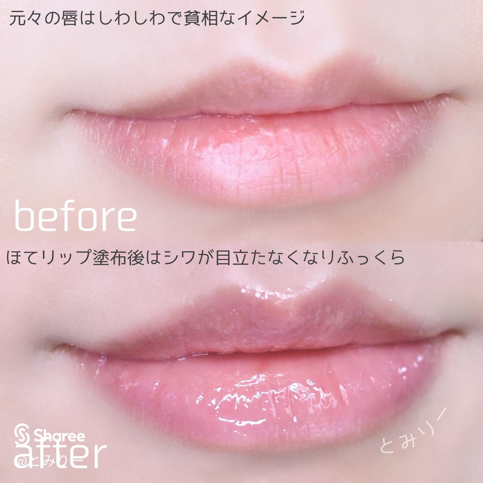 幻のほてリップ プランパー効果でぷっくり唇に とみりーが投稿したフォトブック Sharee