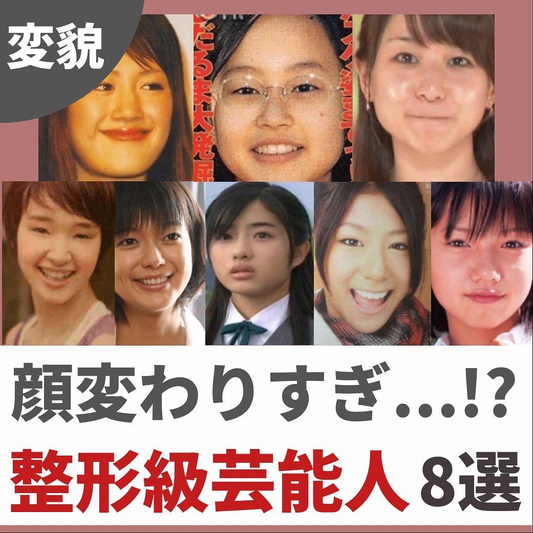 顔変わりすぎ 整形級芸能人8選 スキンケアコーくんが投稿したフォトブック Lemon8