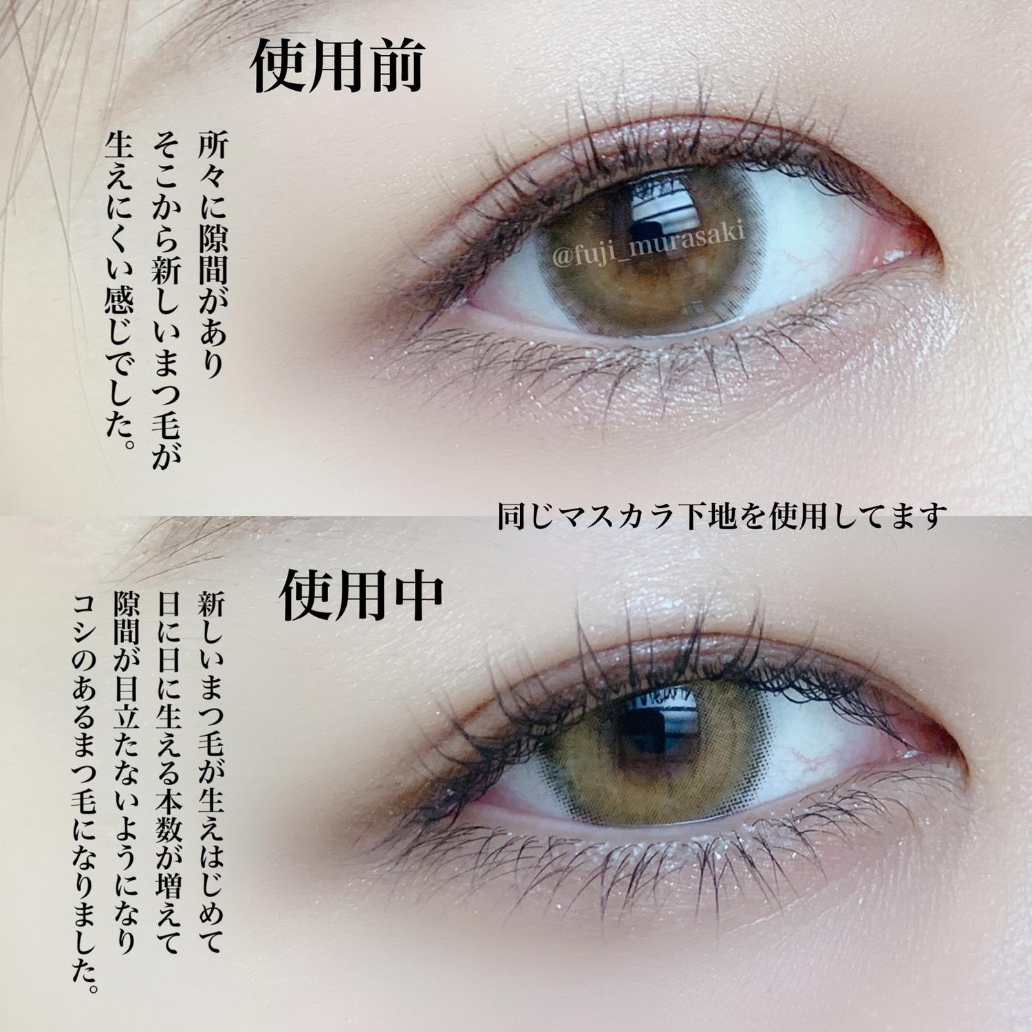 Revive Lashでまつ毛を増やす Fujiが投稿したフォトブック Sharee