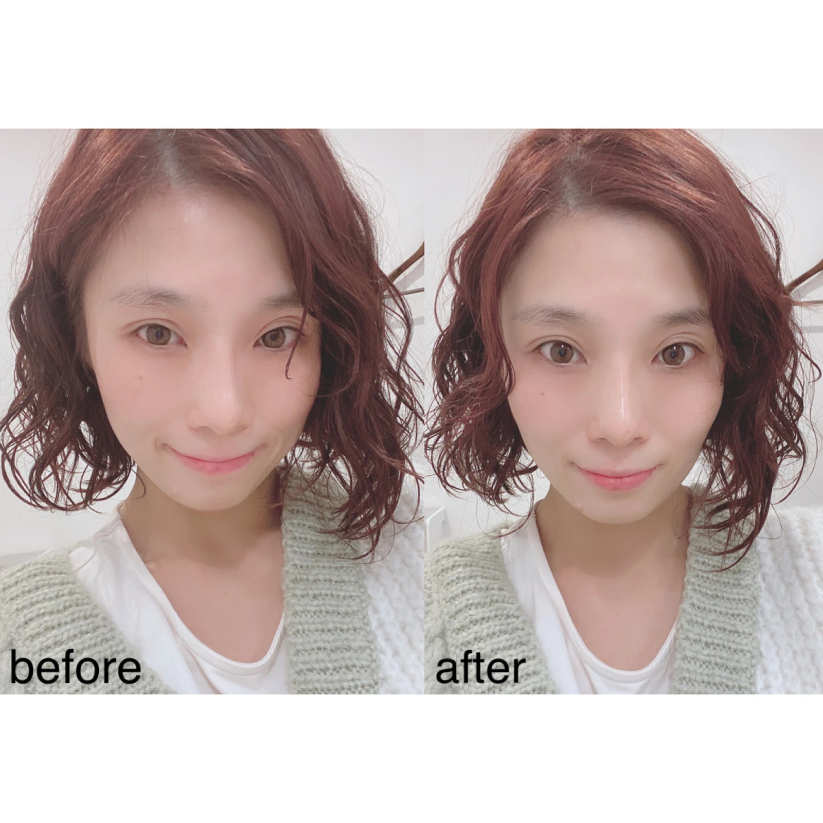 はじめてのハイフ体験 花村映実が投稿したフォトブック Lemon8