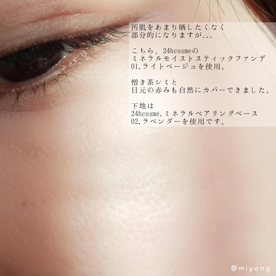肌悩みがある大人女子にこそ試してほしい Miyongが投稿したフォトブック Sharee