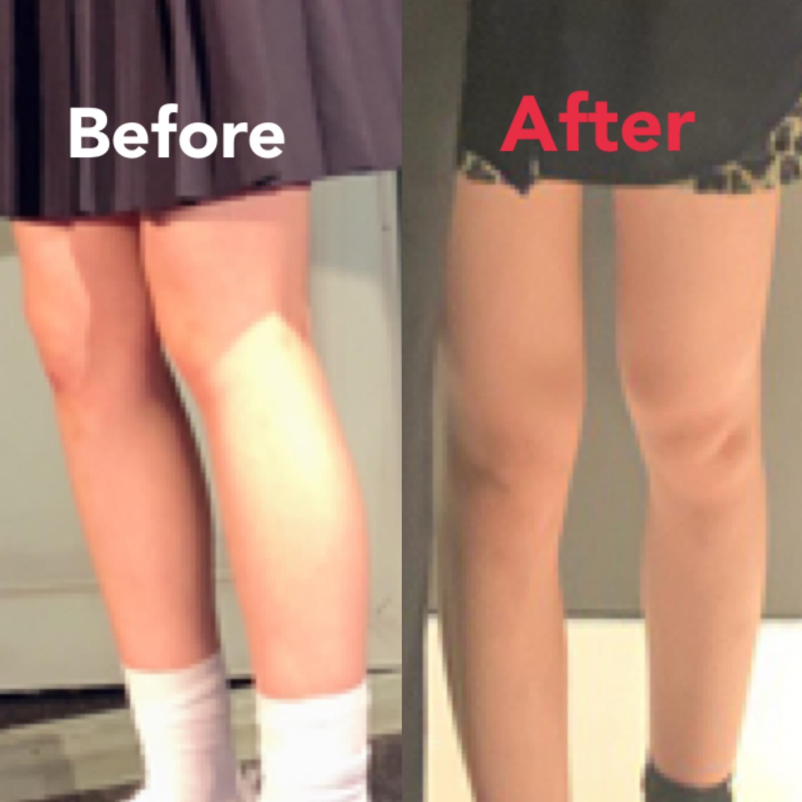 下半身太り1ヶ月で解消 Zonooが投稿したフォトブック Lemon8