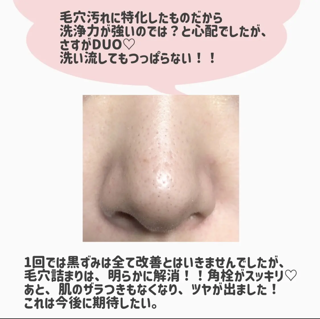 Lemon8 Story 夢みるバーム 毛穴 黒ずみ