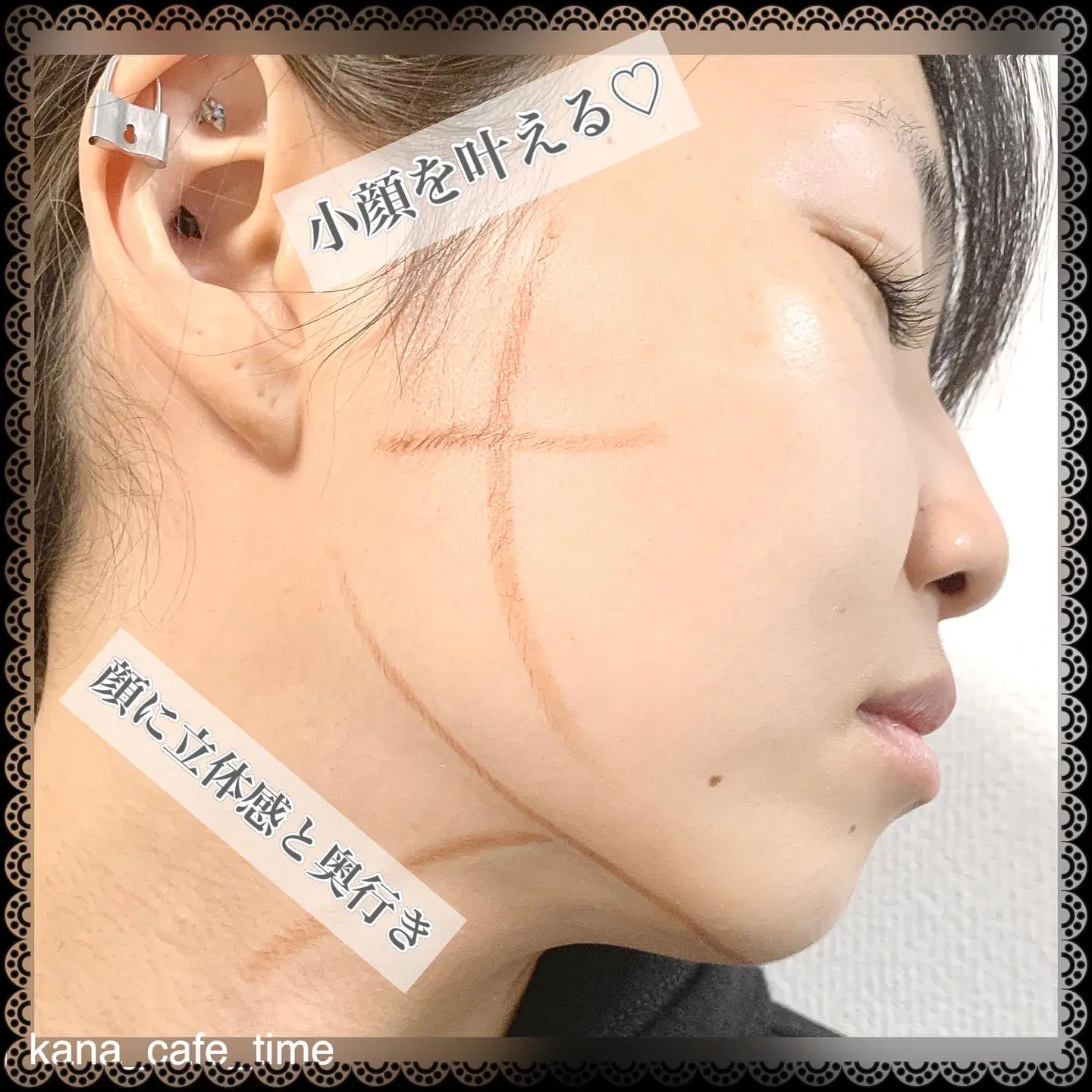 Lemon8 Story ピップエレキバン 小顔