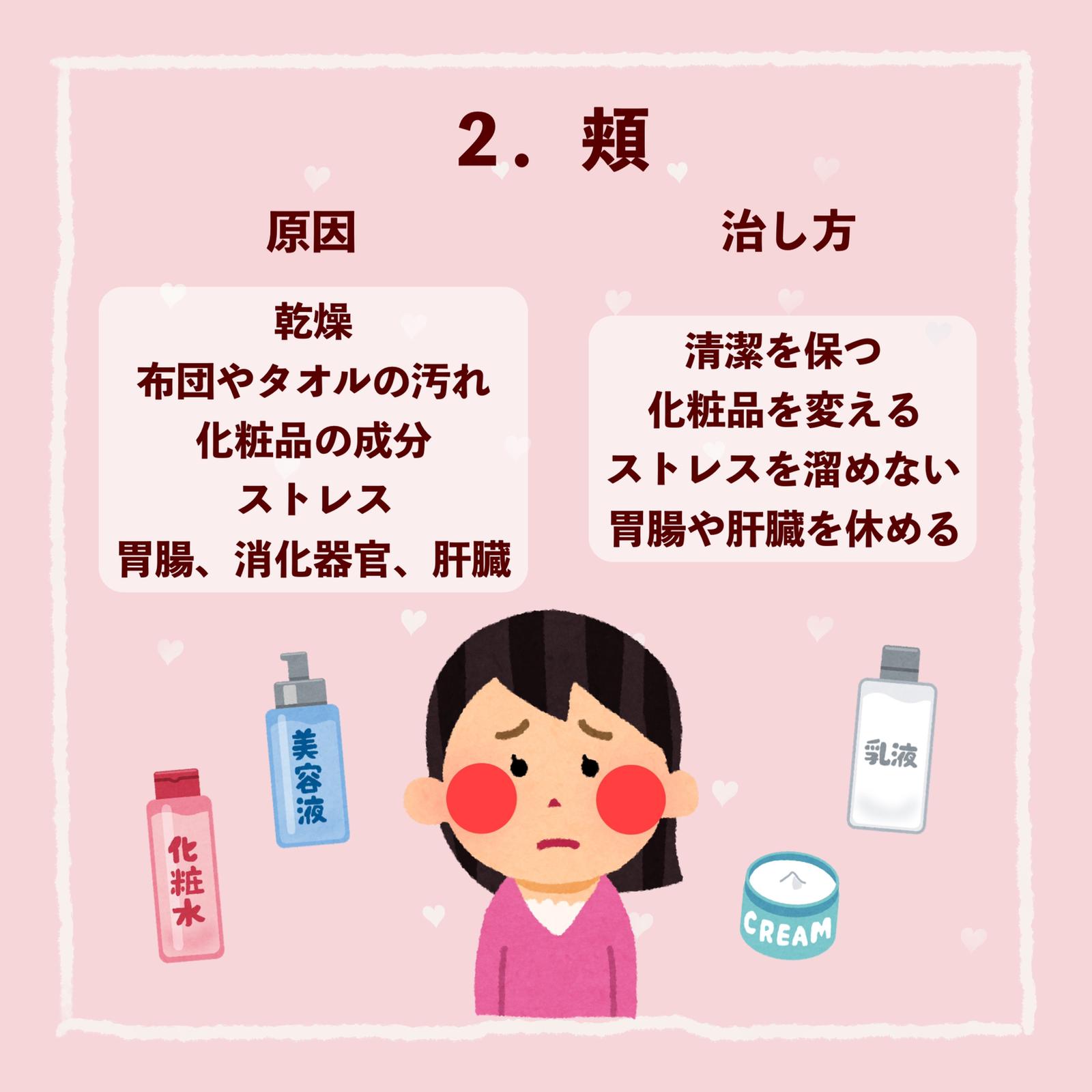 ニキビの場所別 原因と治し方 ぽん Cosmeが投稿したフォトブック Lemon8