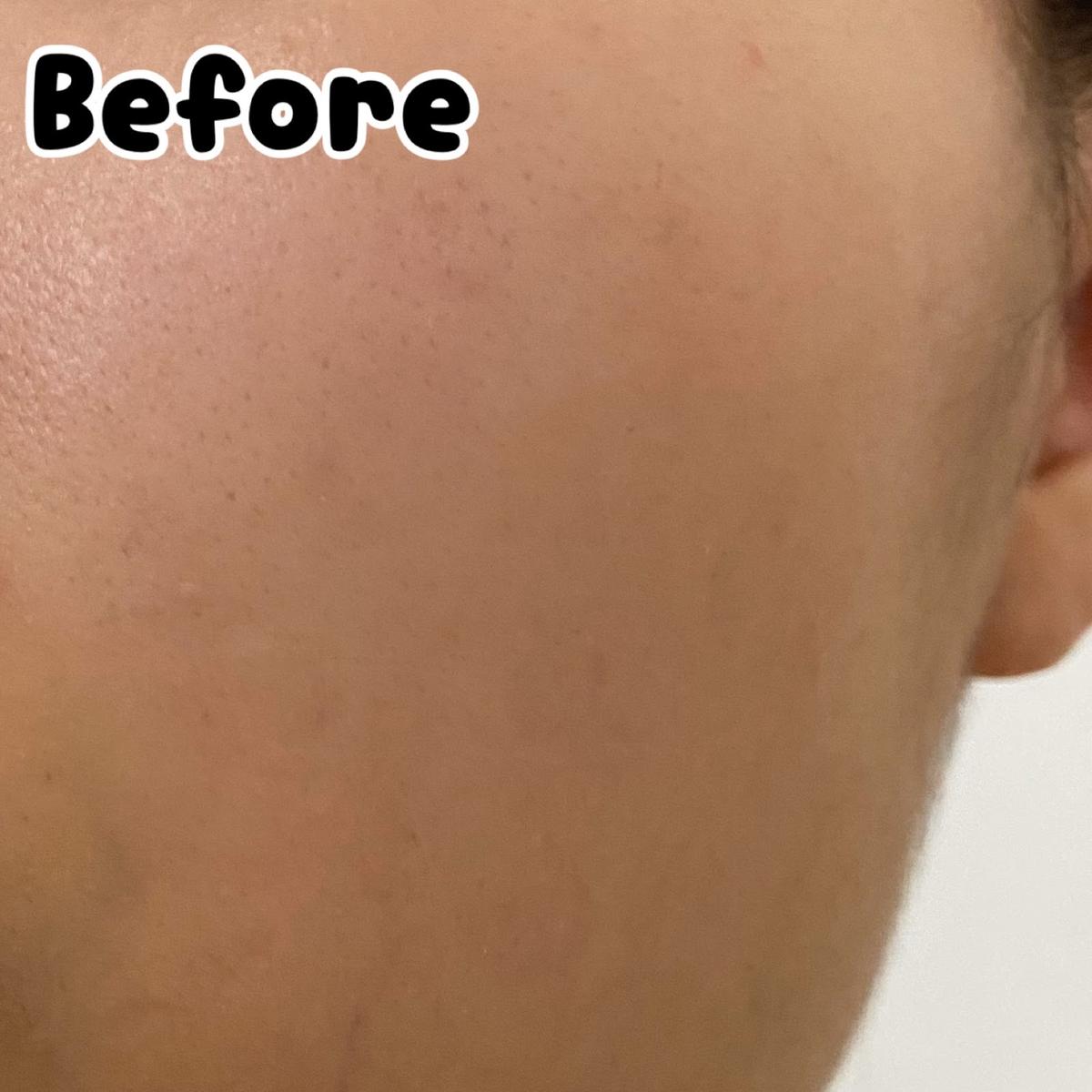 グーダルのビタcセラムマスク めっちゃ肌白くなった あやさが投稿した記事 Sharee