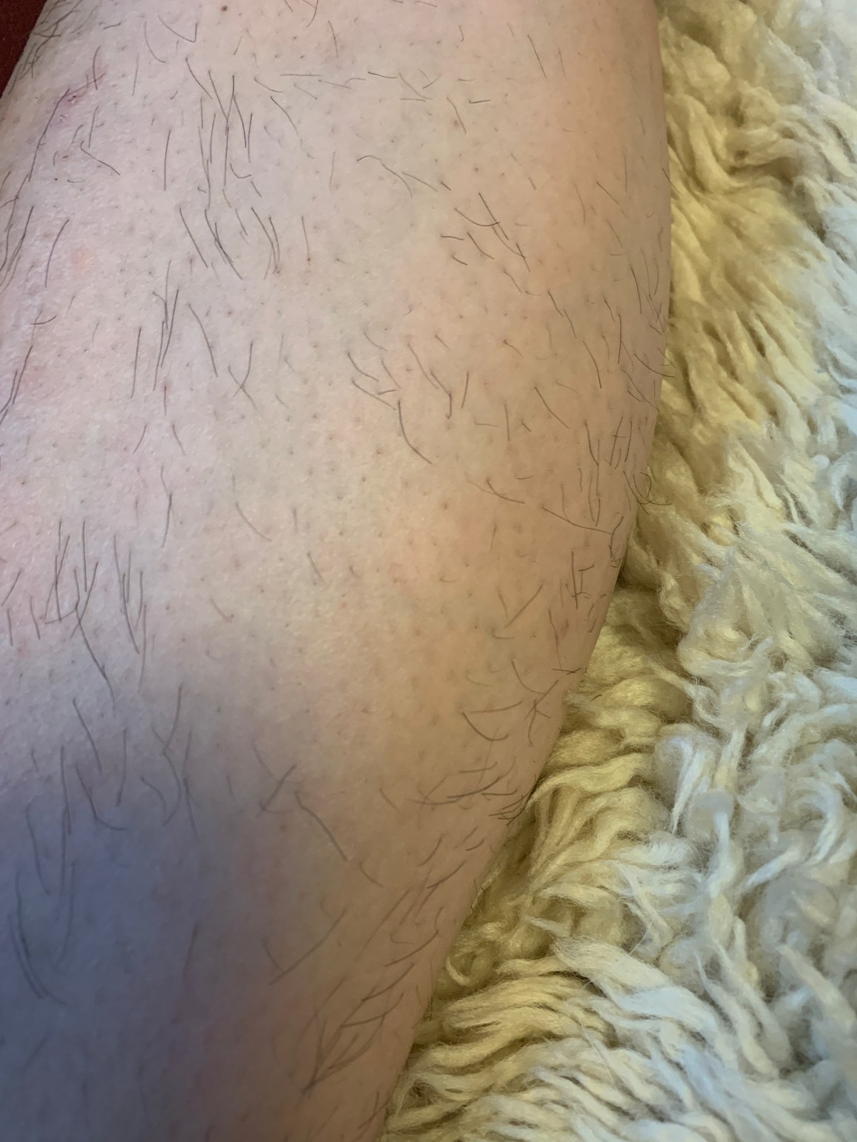 Lemon8 Story すね毛処理 剃り方