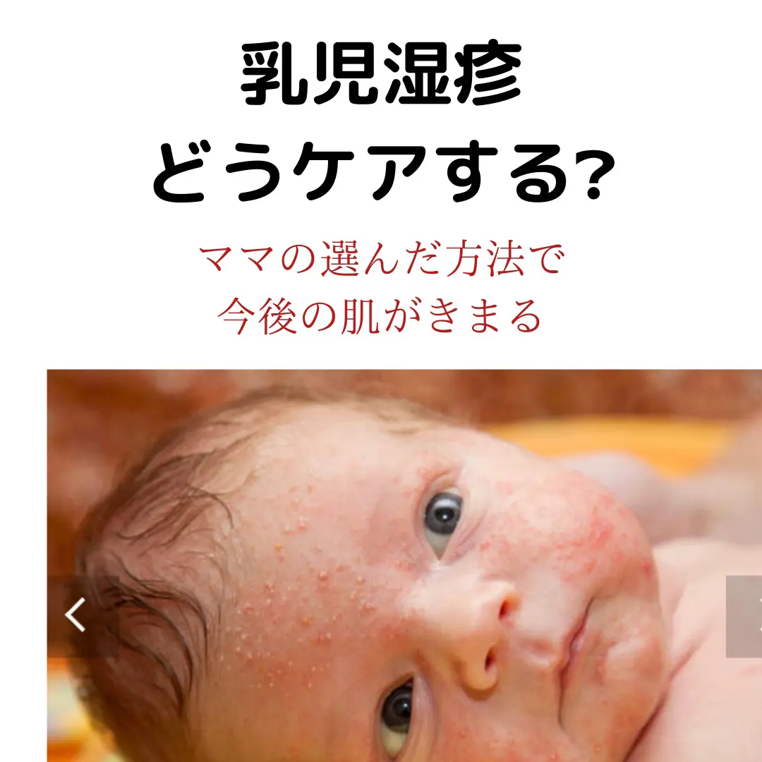 乳児湿疹について 悩んでない ちなっちゃん が投稿したフォトブック Lemon8