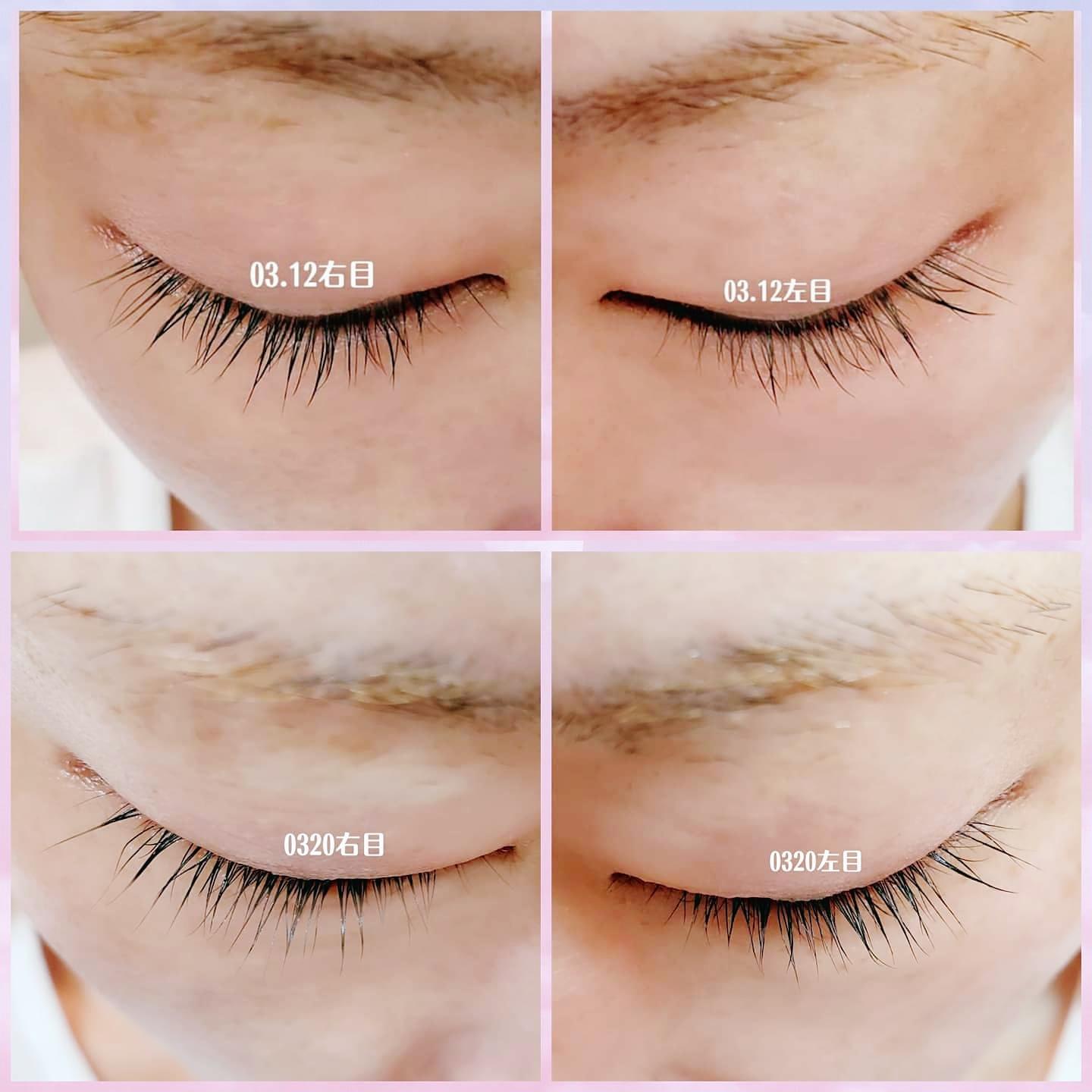 自まつ毛ケア強化中記録 Hiromi 38が投稿したフォトブック Sharee