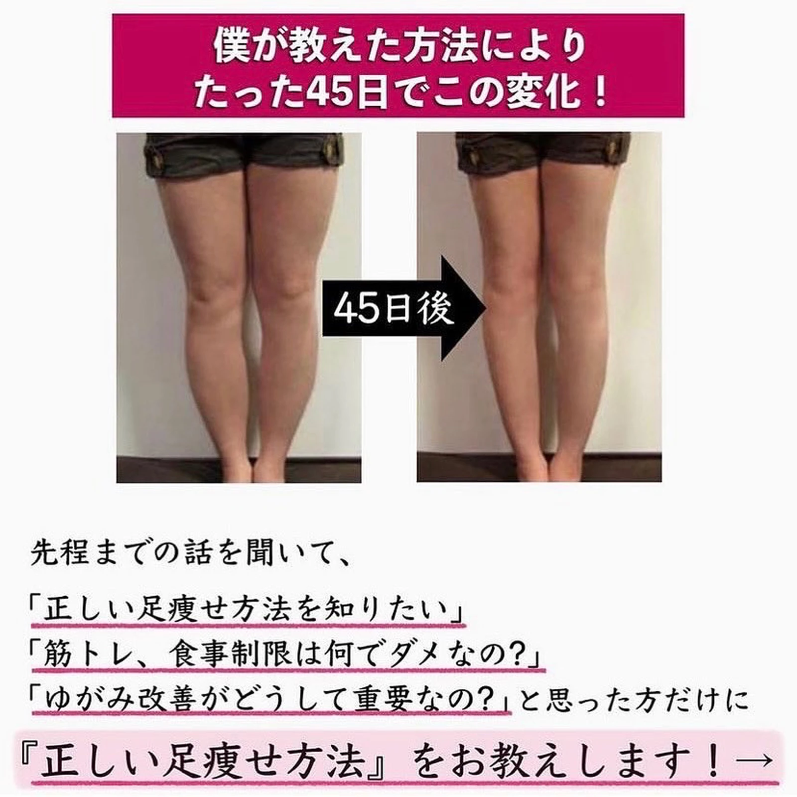 足が太い女性の特徴 1日5分で脚痩せが投稿したフォトブック Lemon8