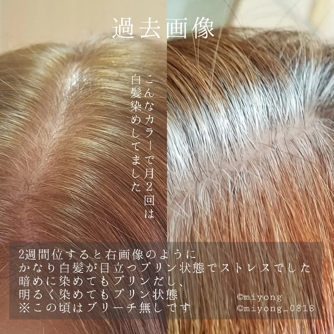 脱白髪染め 白髪ぼかしハイライト Miyongが投稿したフォトブック Lemon8 脱白髪染め 白髪ぼかしハイライト Miyongが投稿したフォトブック Lemon8