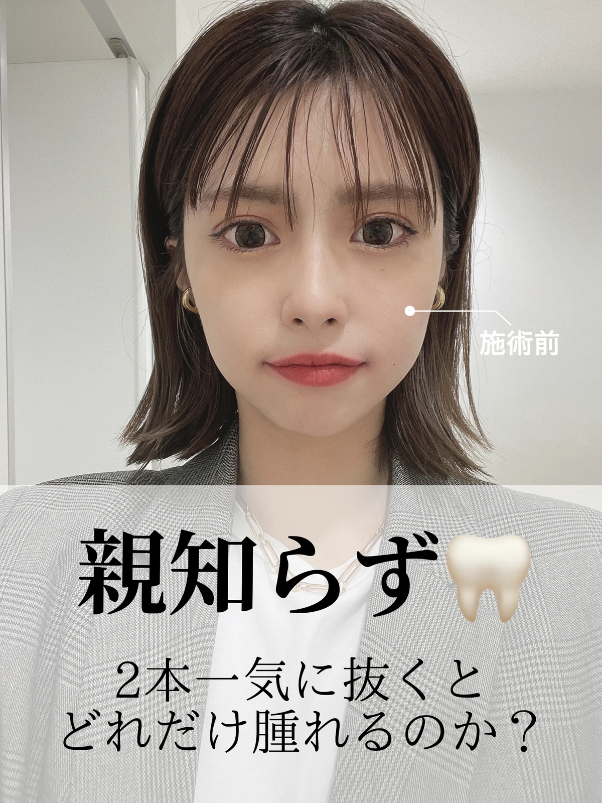 親知らず検証 橘ひろなが投稿したフォトブック Lemon8