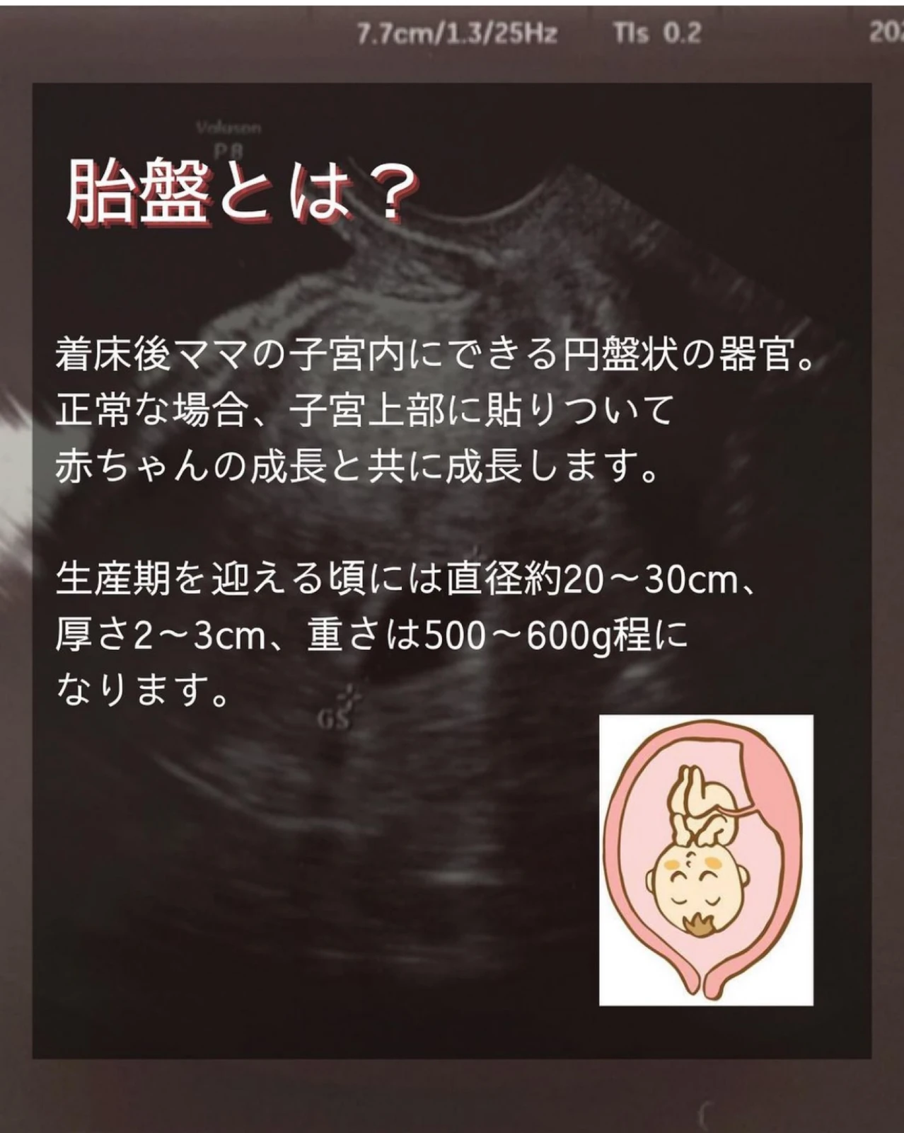 今さら聞けない 胎盤とは Usuke 新米パパが投稿したフォトブック Lemon8