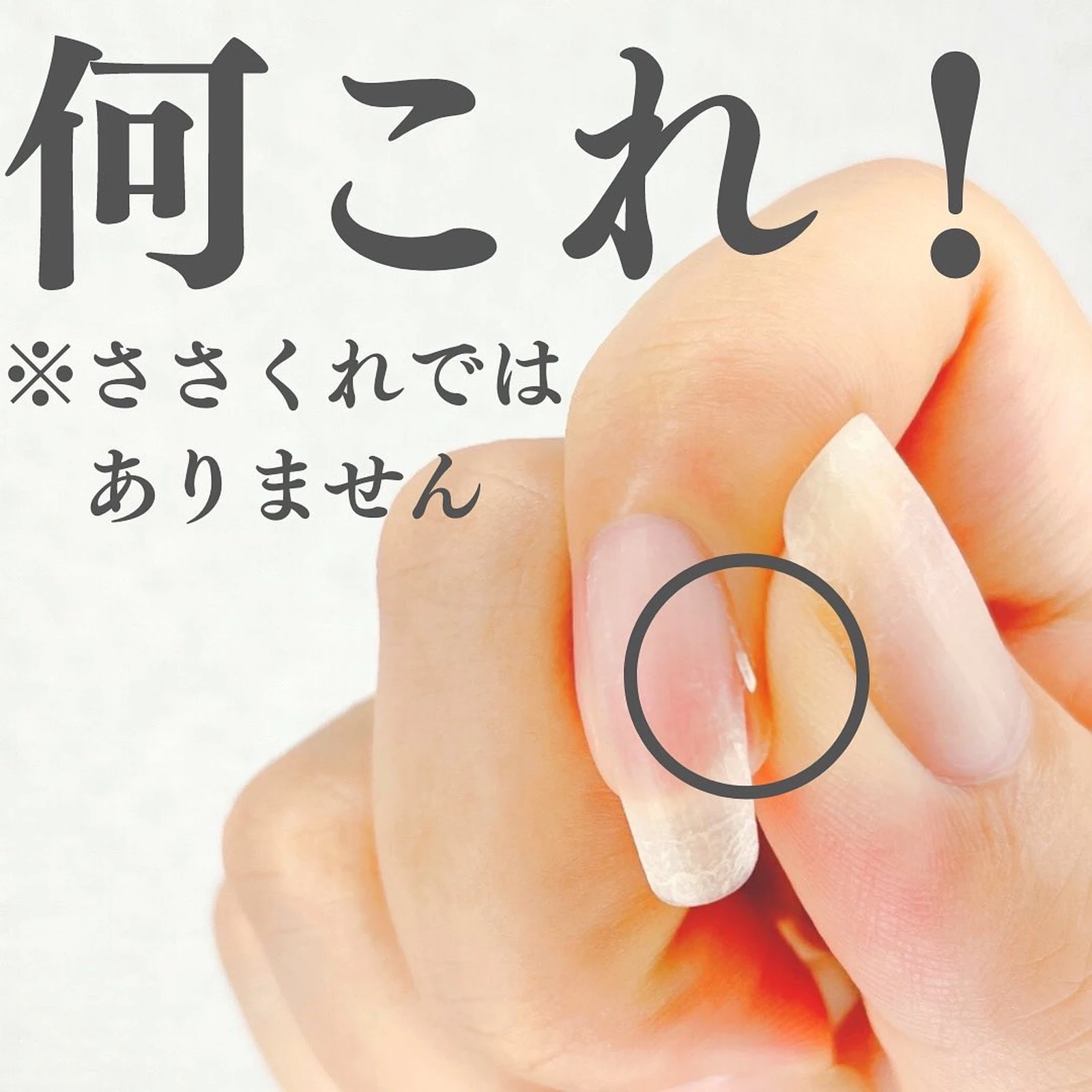 爪の脇からでてくるこれ 何 メンズマニキュアリストなべさんが投稿したフォトブック Lemon8