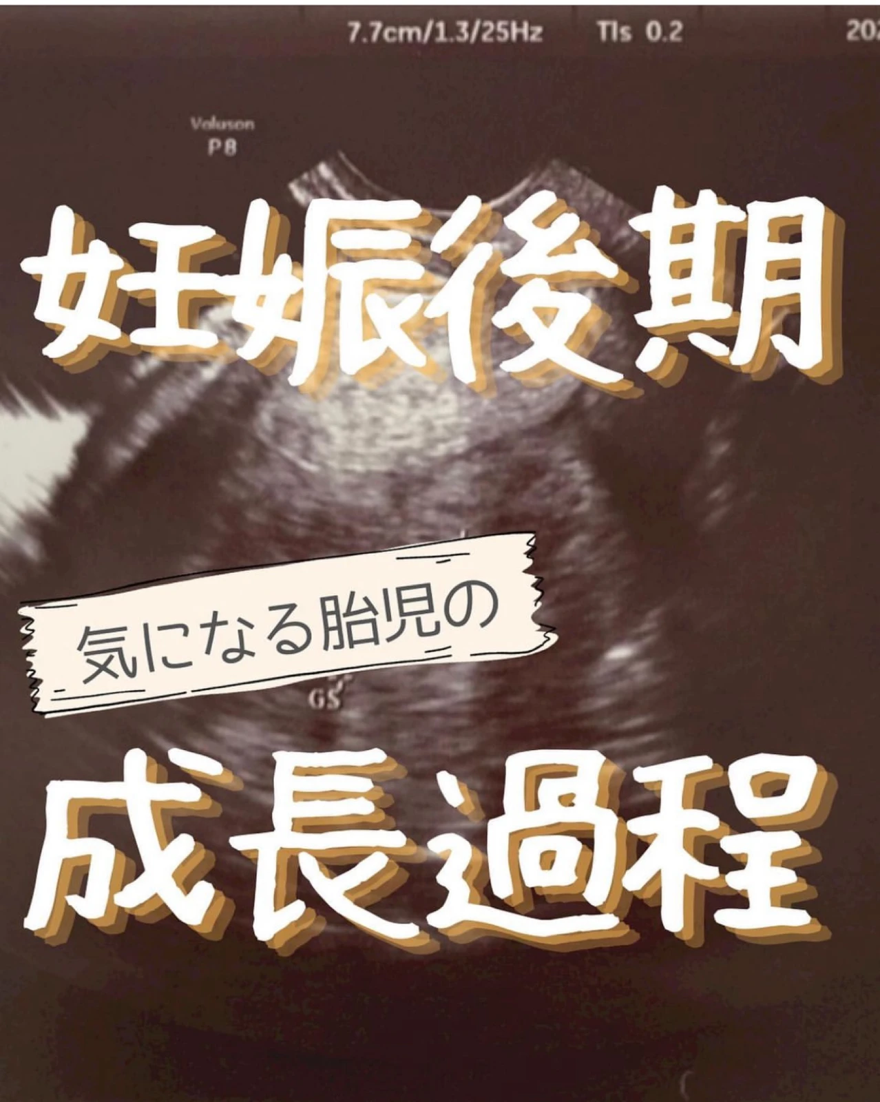 胎児シルエット Lemon8