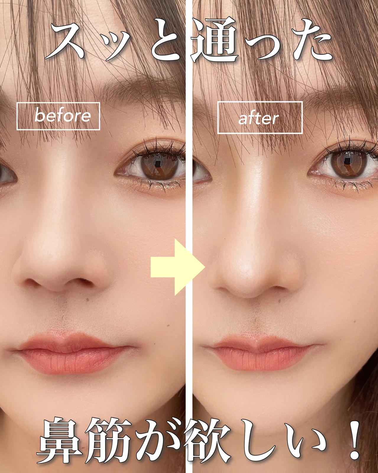 鼻が小さくなる Lemon8