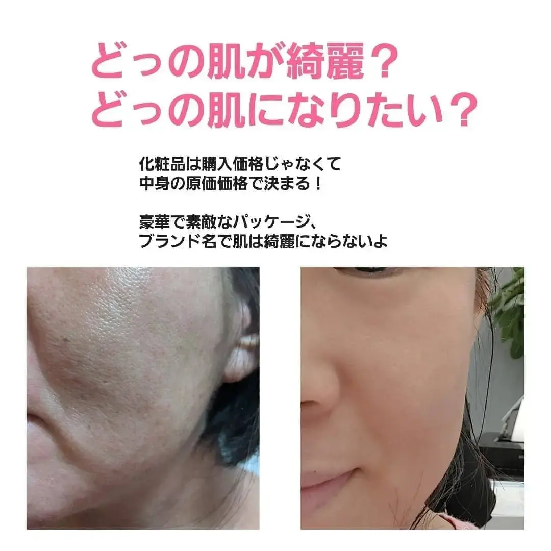 脱 毛穴 乾燥 肌のお悩み 美肌カウンセラーyukiが投稿したフォトブック Lemon8 脱 毛穴 乾燥 肌のお悩み 美肌カウンセラーyukiが投稿したフォトブック Lemon8