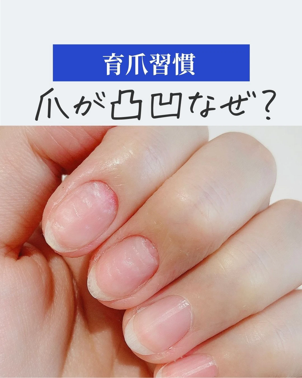 爪は健康のバロメーター ポリッシュ ネイルケアふみこが投稿したフォトブック Lemon8