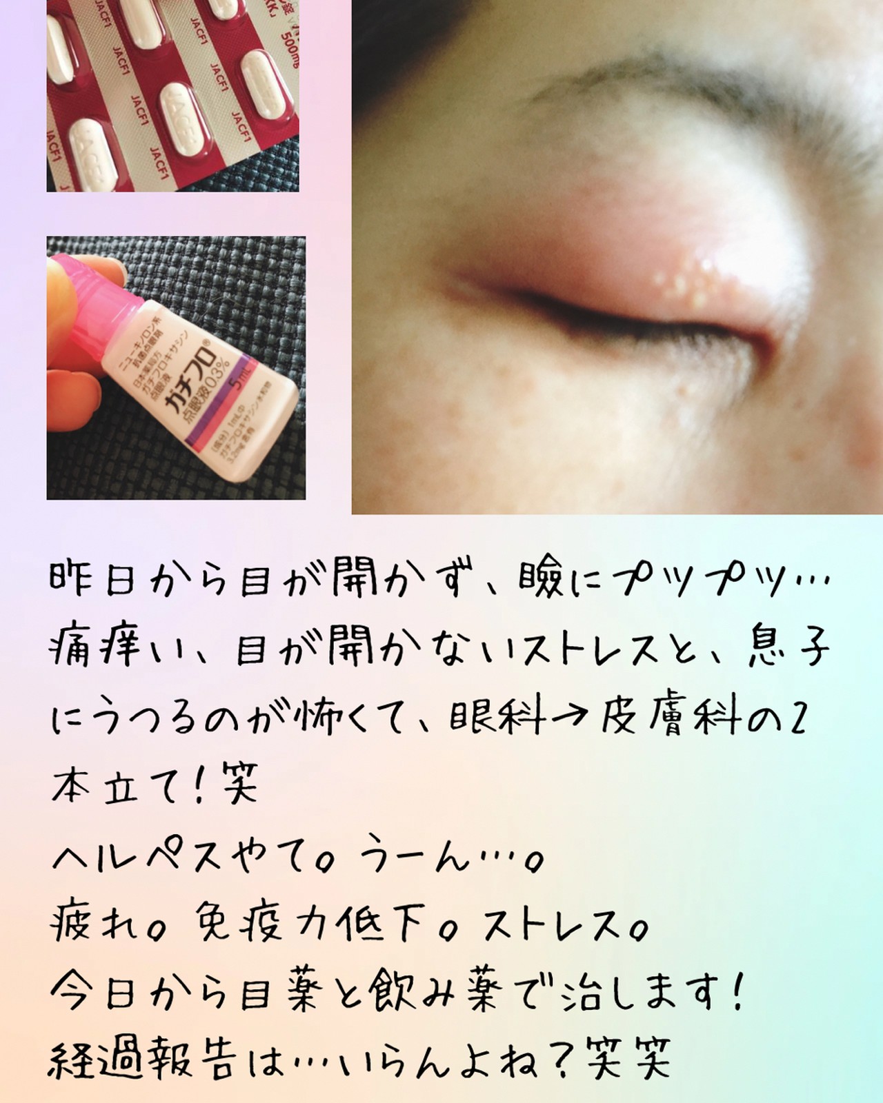 Lemon8 Story ヘルペス Lemon8 Story ヘルペス