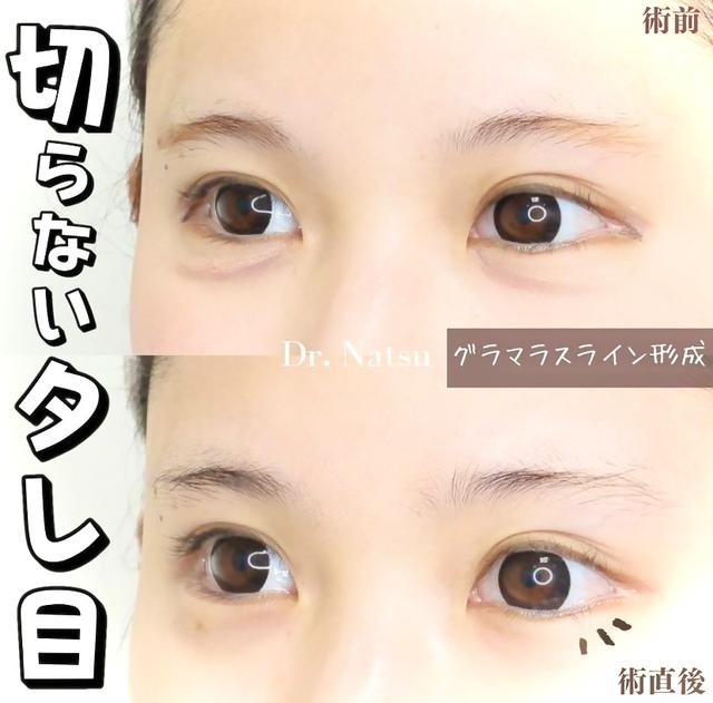 垂れ目に関する最新の人気投稿 Lemon8