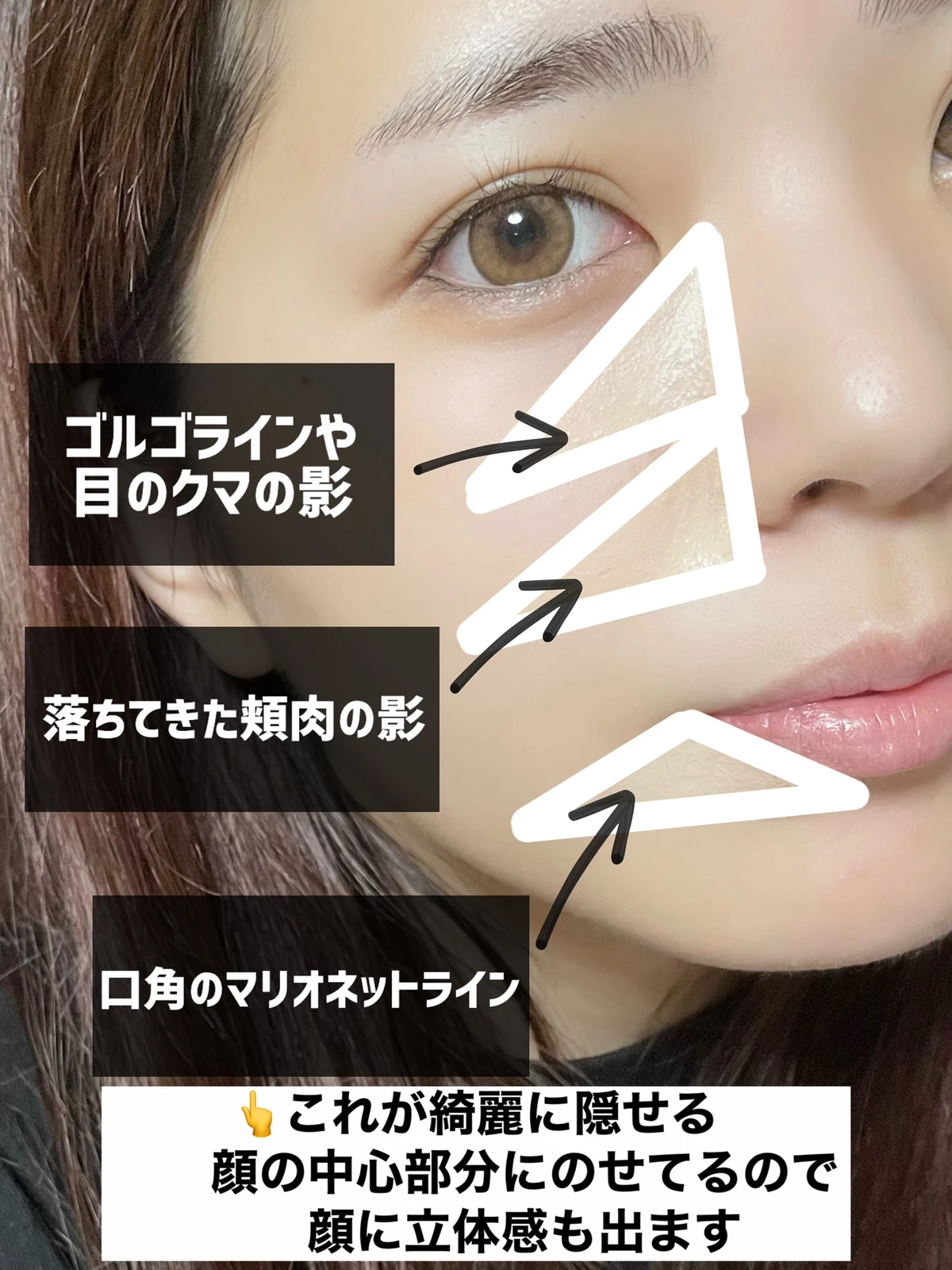 ゴルゴ線の消し方 Lemon8