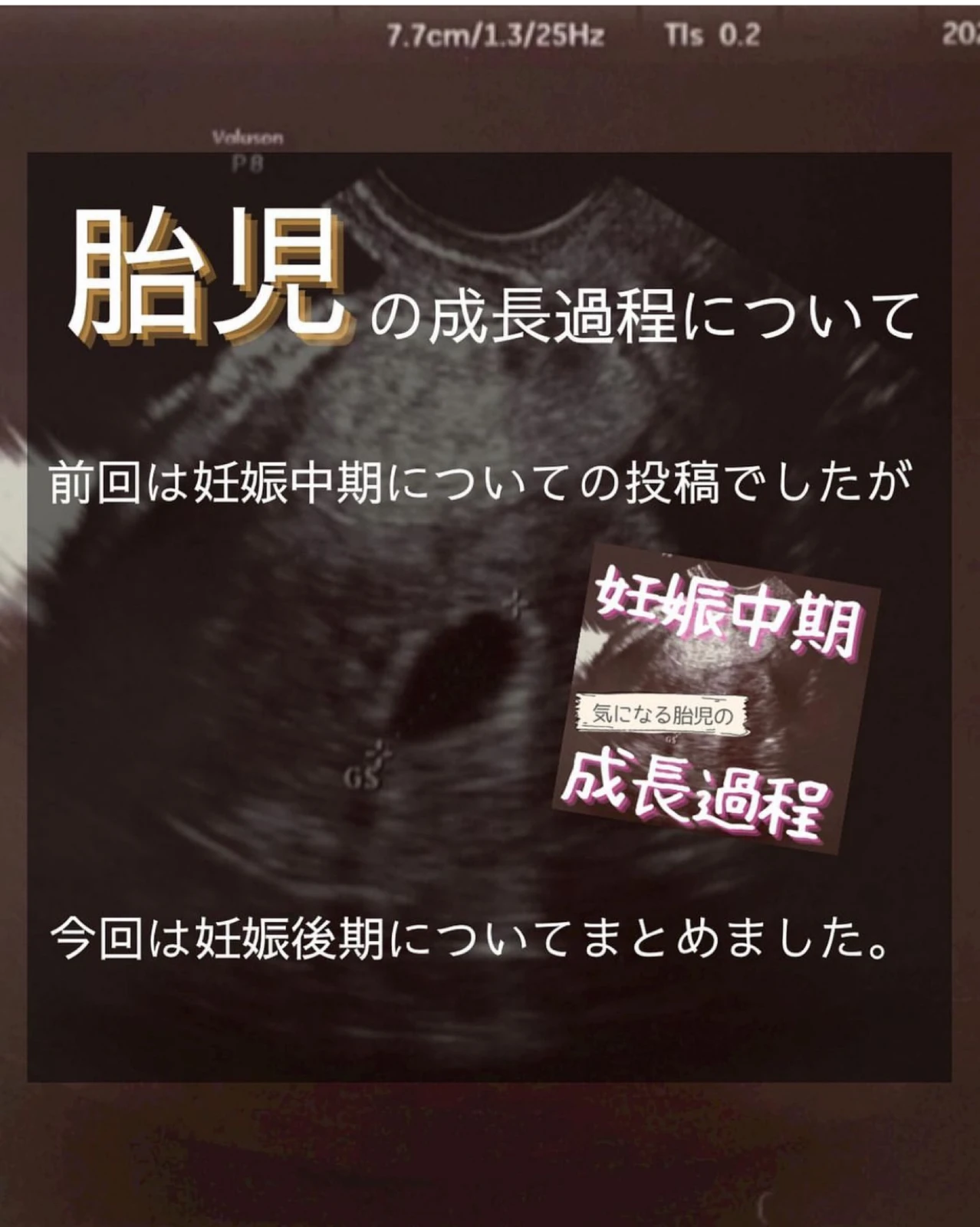 胎児シルエット Lemon8