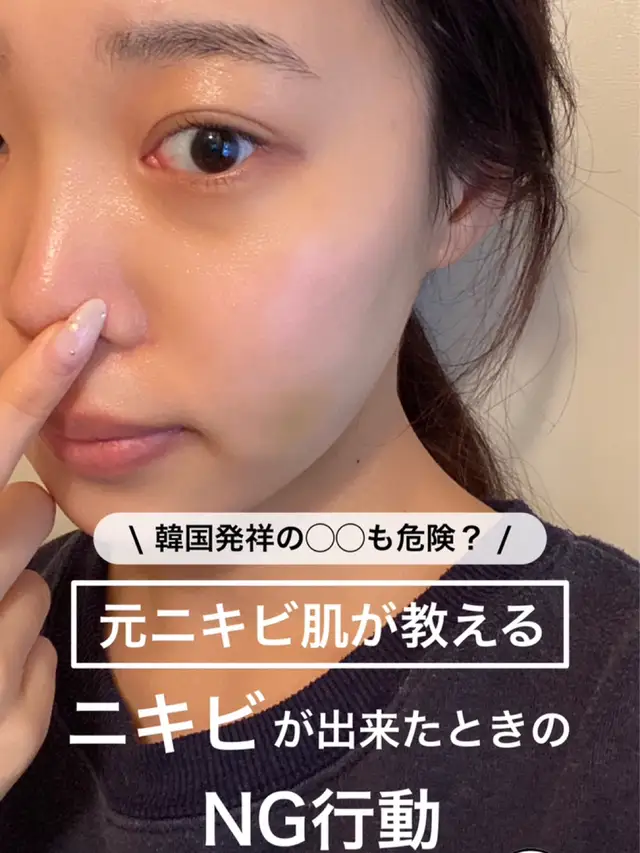 元ニキビ肌が教える Ng行動 韓国の も危険 Yuuukan02が投稿した記事 Lemon8 元ニキビ肌が教える Ng行動 韓国の も危険 Yuuukan02が投稿した記事 Lemon8