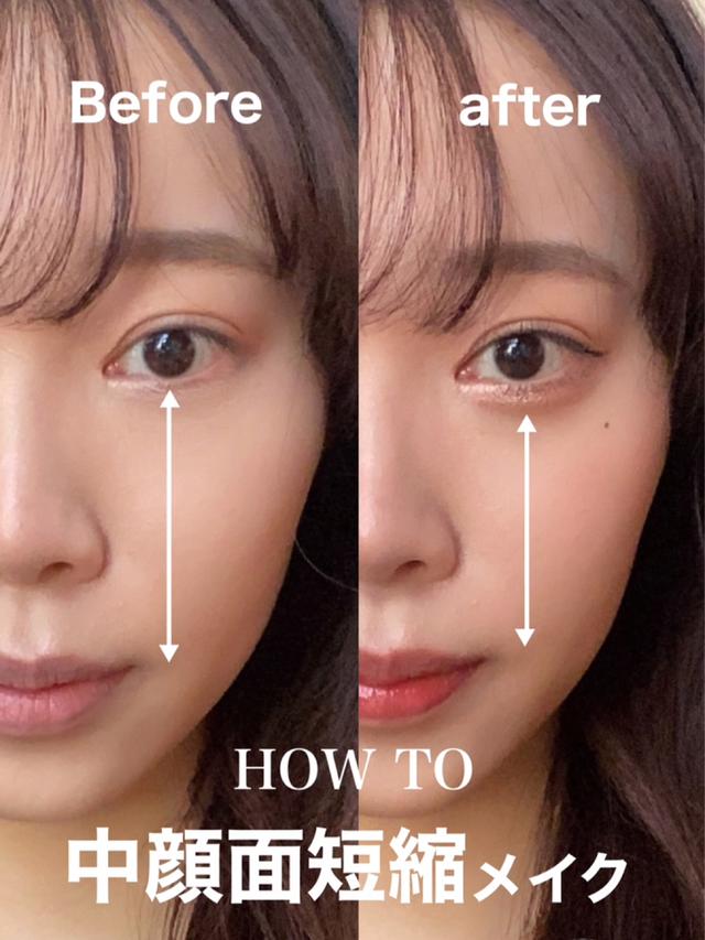 中顔面短縮に関する最新投稿と人気の投稿 Lemon8