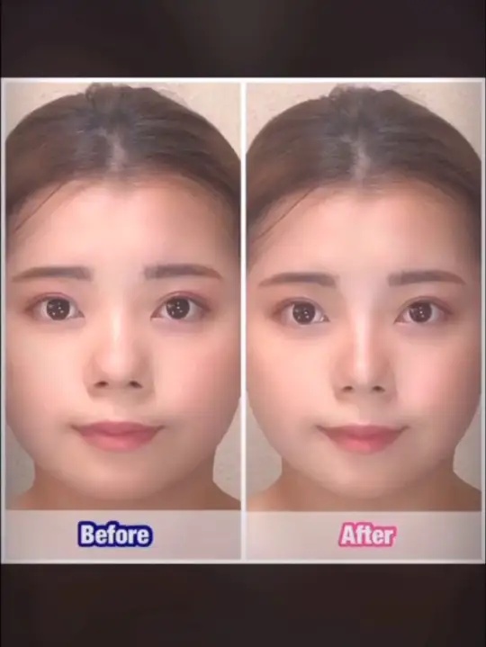 Lemon8 Story だんご鼻 画像