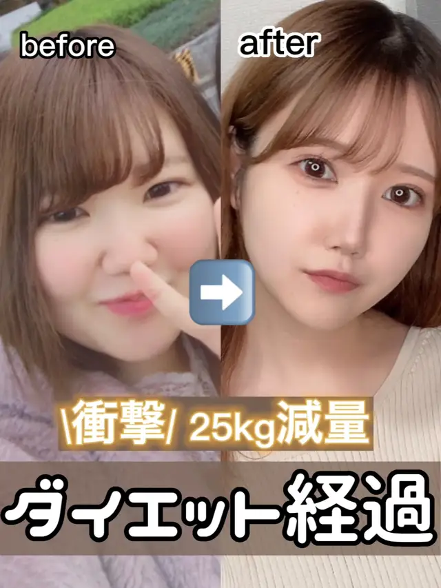Lemon8 Story ダイエット 顔 ビフォーアフター