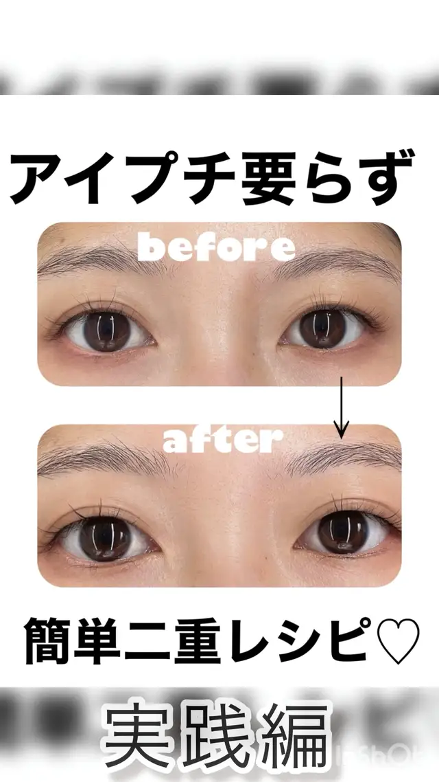 Lemon8 Story シーイン アイプチ