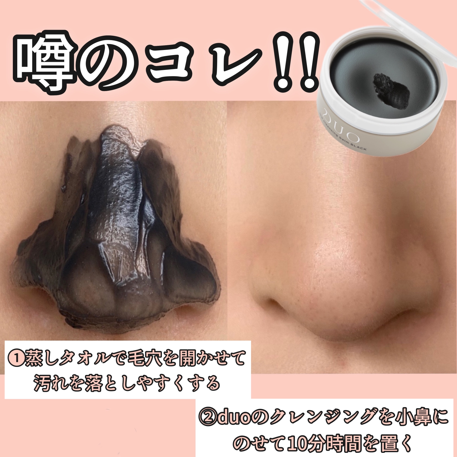 毛穴の黒ずみケアの方法 Mariasakamotoが投稿したフォトブック Sharee