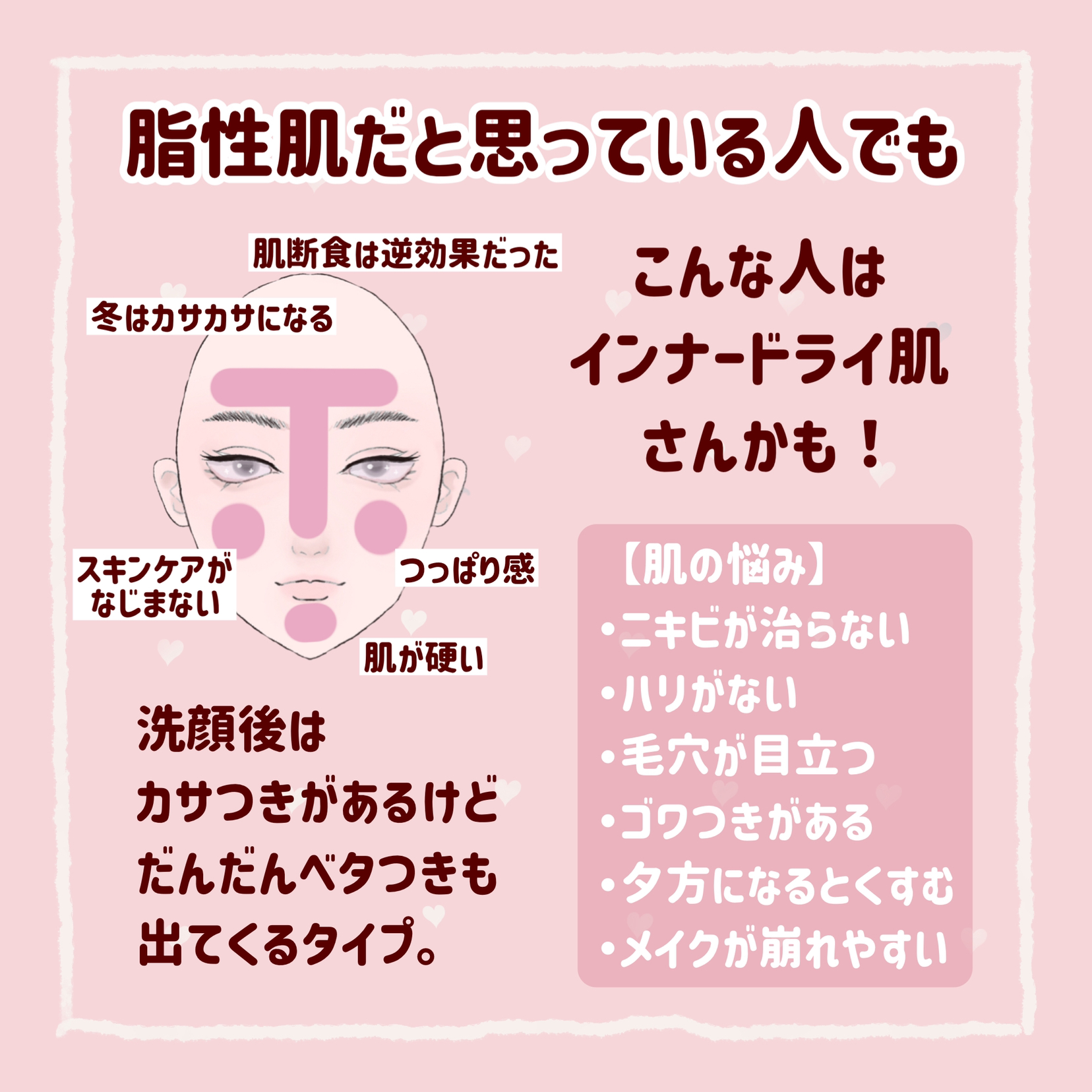 肌タイプ診断とスキンケア方法 Kumacosmeが投稿したフォトブック Lemon8