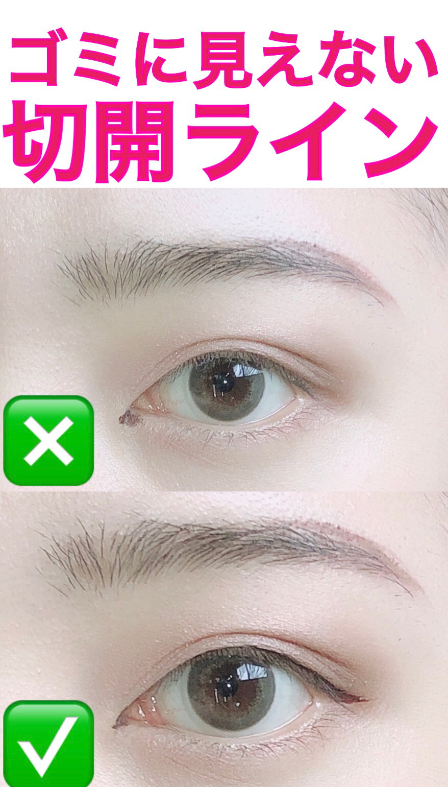 ゴミに見えない切開ラインの引き方 チャンさんが投稿した記事 Sharee