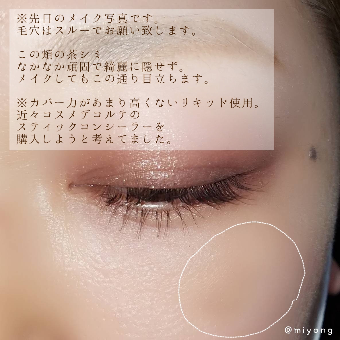 肌悩みがある大人女子にこそ試してほしい Miyongが投稿したフォトブック Sharee