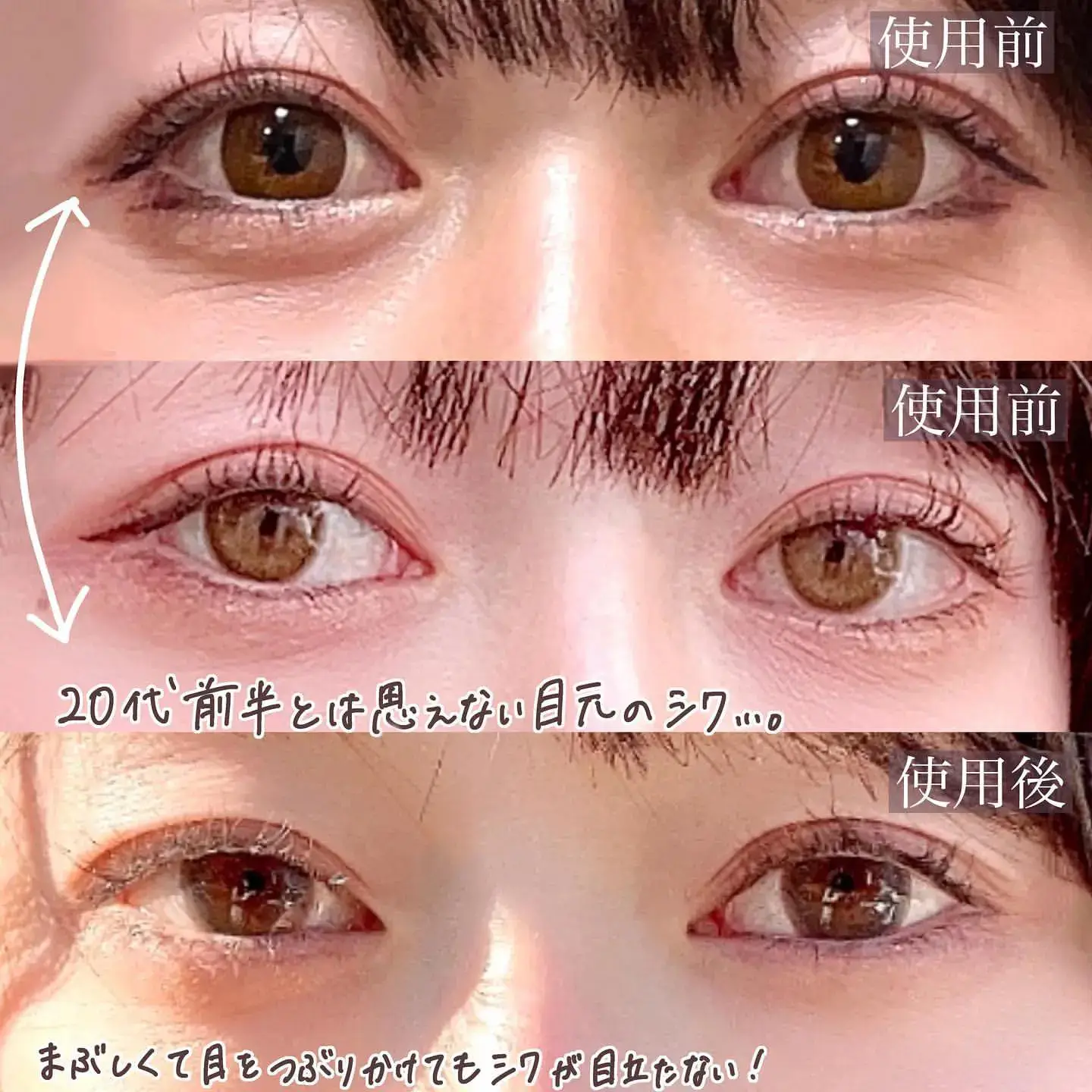 シックプリケア 代女子 Lemon8