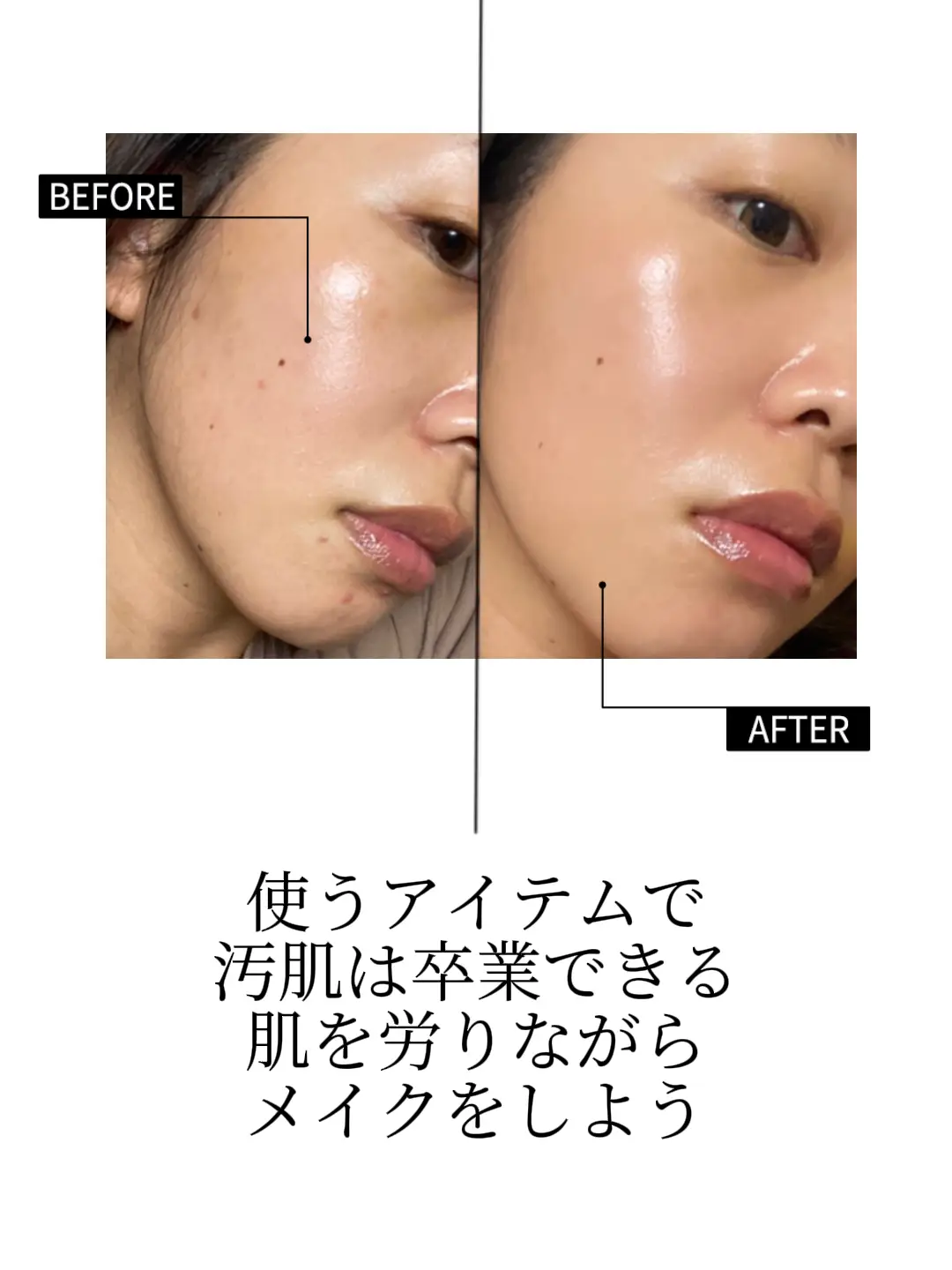汚肌卒業 無人島にも夏のレジャーにも絶対崩れない 焼かない 美肌キープ Miomaruが投稿したフォトブック Lemon8 汚肌卒業 無人島にも夏のレジャーにも絶対崩れない 焼かない 美肌キープ Miomaruが投稿したフォトブック Lemon8