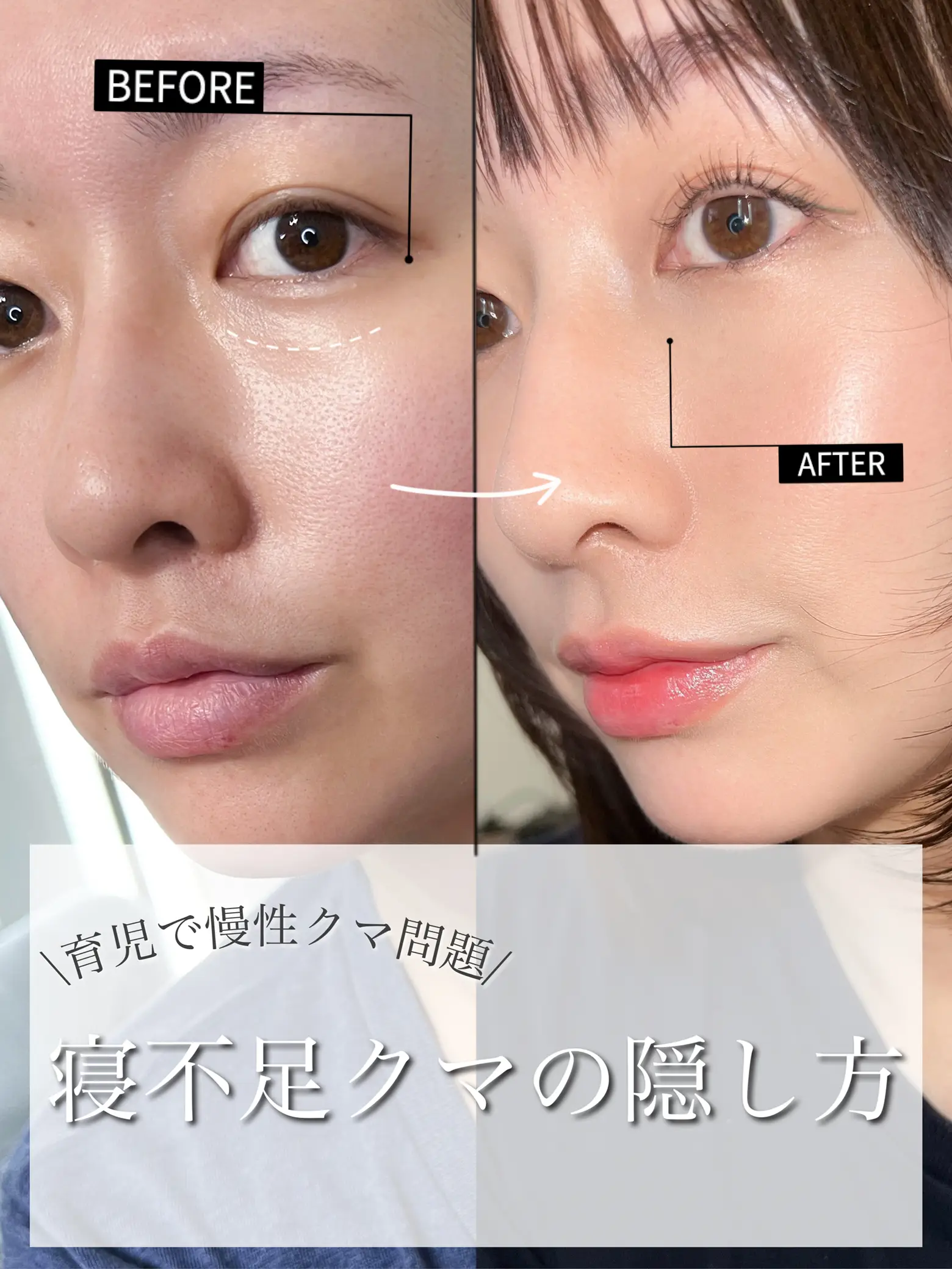 万年寝不足 どんより青クマ隠しメイク Kame Coが投稿したフォトブック Lemon8